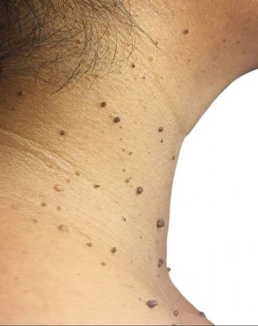 terapeuta Heloana oliveira/terapias manuais , conheça ! Heloana oliveira/terapias manuais , conheça !