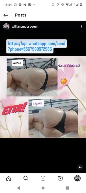 Massagem tântrica, orgasmo múltiplos , ventosaterapia ,Drenagem l Massagem