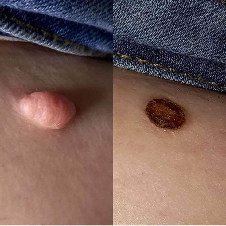 Heloana oliveira/terapias manuais , conheça ! Massagem nuru
