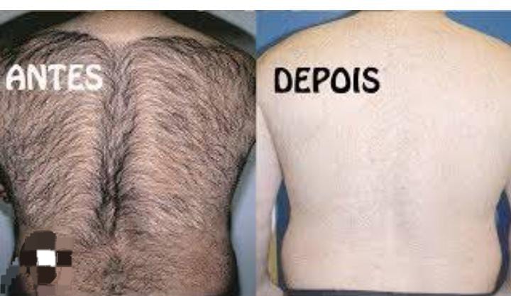 Erika mão de nuvem Massagem sensual em