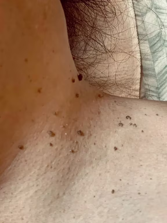Heloana oliveira/terapias manuais, conheça ! Massagem nuru