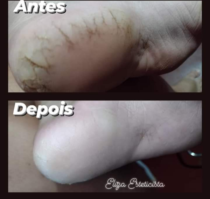 Eliza massoterapia e Estética Massagem