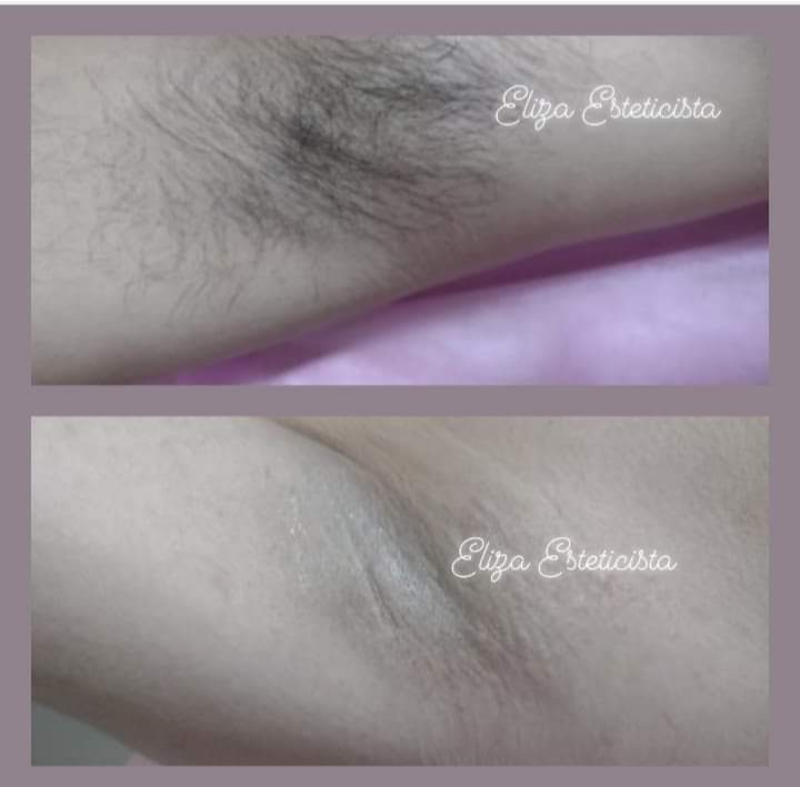 liza massoterapia e Estética Massagem liza massoterapia e Estética Massagem