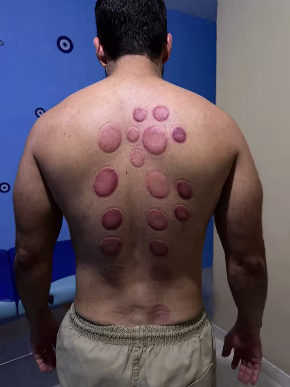 NOSSO SPA Permita correr para seu refúgio na Orla da Atalaia Massagem tântrica em